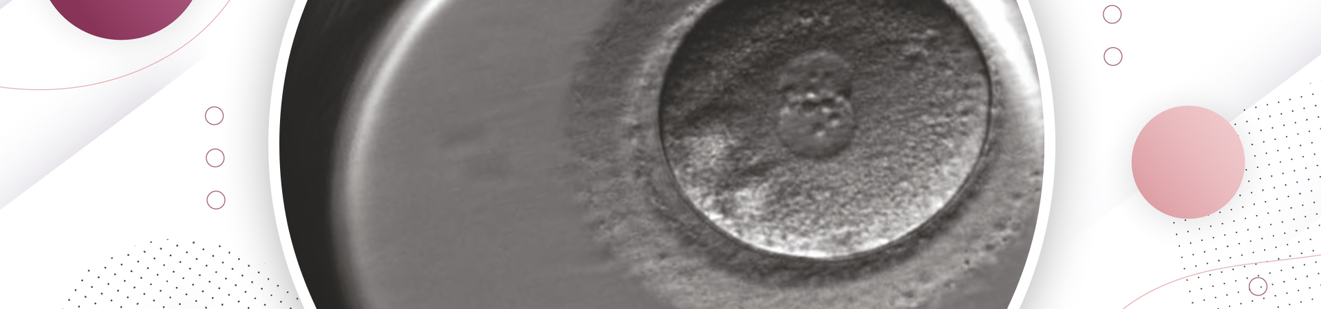 Advanced Inertility Treatment - Embryoscope