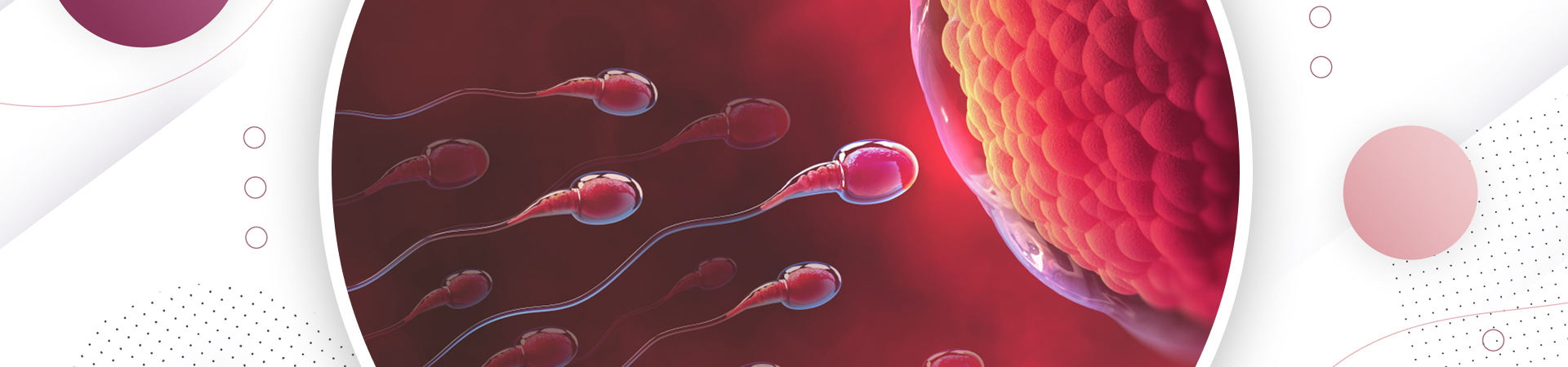 Infertility Treatments