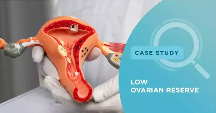 Self-cycle IVF results in healthy twin boys for a woman with poor ovarian reverse
