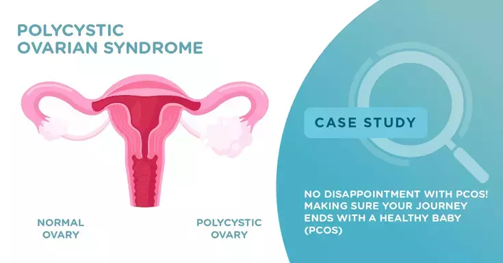 No disappointment with PCOS! Making sure your journey ends with a healthy baby