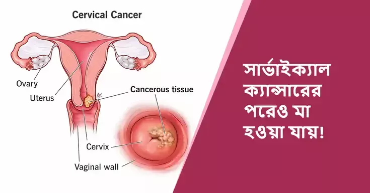cancer