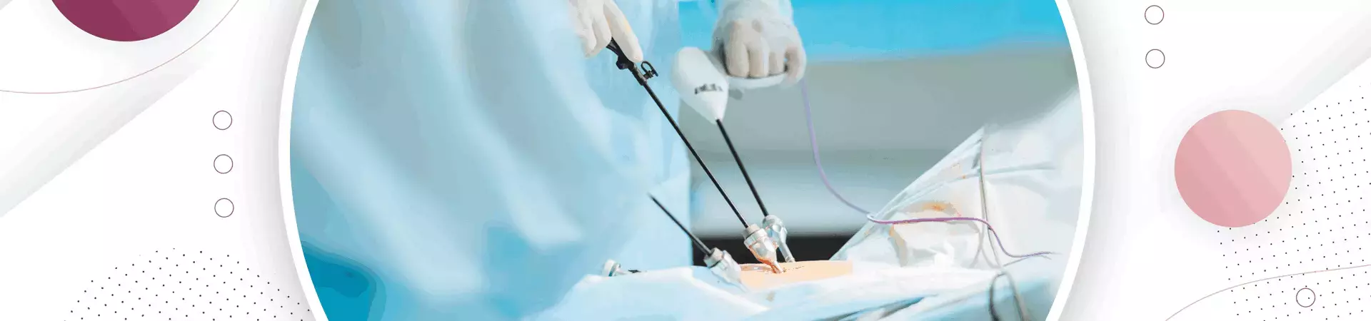 Endoscopy Treatment