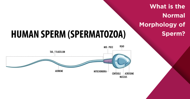 What is Normal Sperm Morphology (Size and Shape)