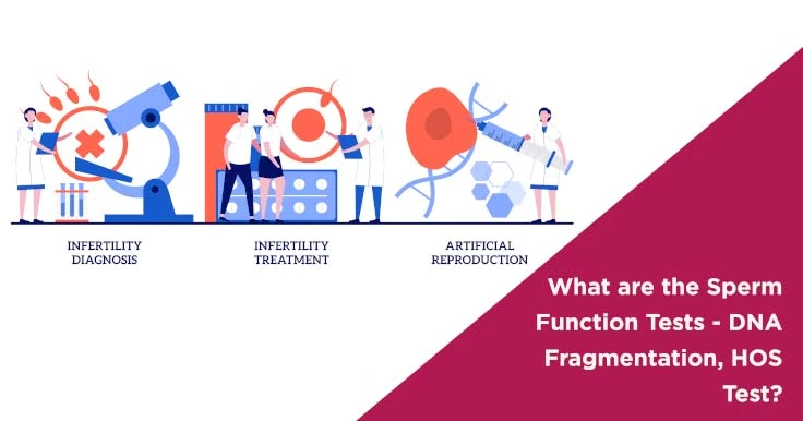  Sperm Function Tests: Understanding DNA Fragmentation and HOS Test