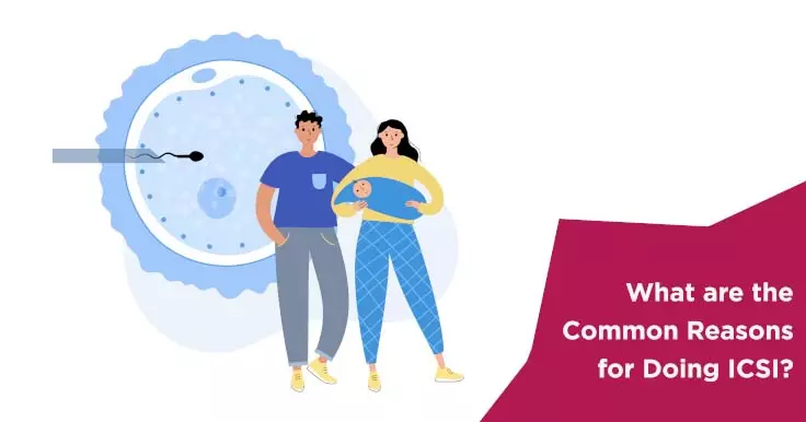  Why Choose ICSI? Key Reasons for Intracytoplasmic Sperm Injection