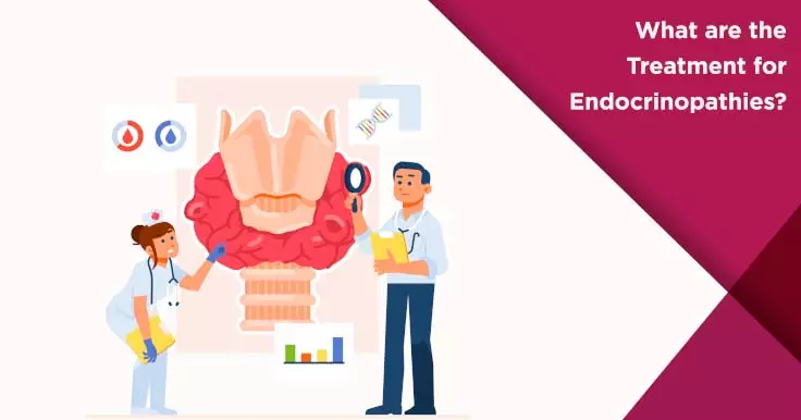  Endocrinopathies and Infertility: Treatment Options Explained