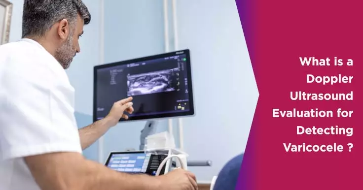  Varicocele Grades and Doppler Ultrasound Evaluation: A Comprehensive Guide