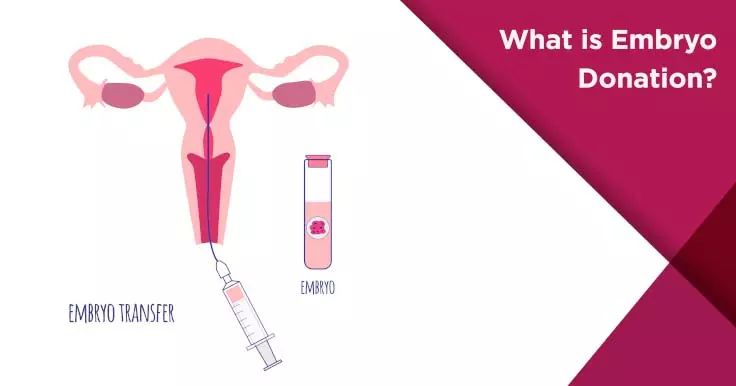  Embryo Donation: Understand its Process