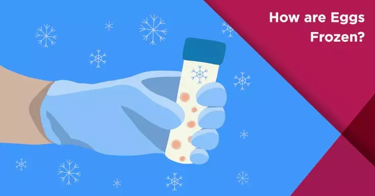  Step-by-Step Guide to the Egg Freezing Process