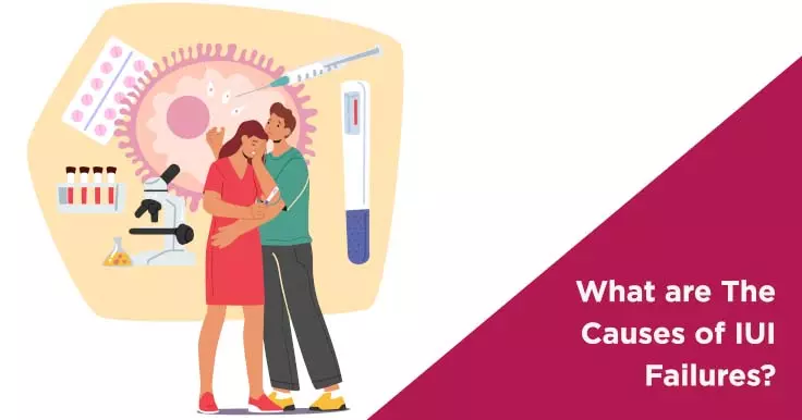  Common Causes of IUI Failure: What You Need to Know