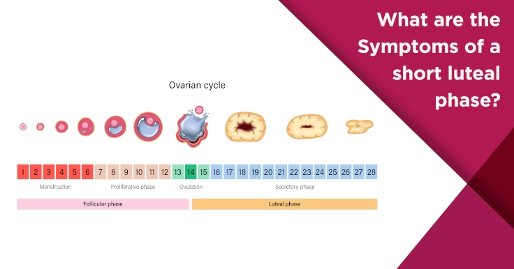  Short Luteal Phase Symptoms: How It Affects Fertility
