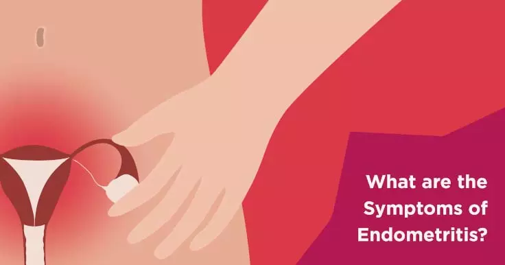  What Are the Symptoms of Endometritis? 