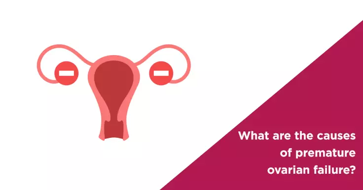  Causes of Premature Ovarian Failure: Understanding the Risks