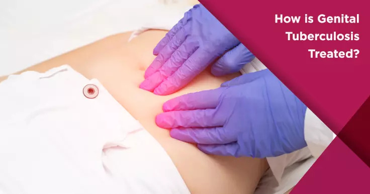  Treatment for Genital Tuberculosis