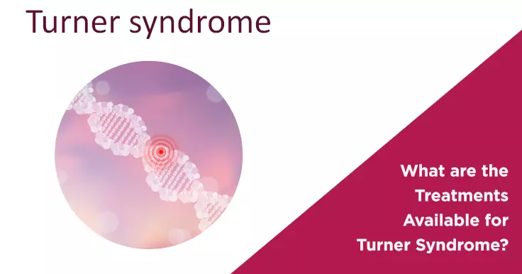  Treatments for Turner Syndrome