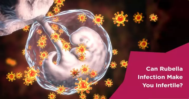  Rubella Infection and Infertility: What You Need to Know
