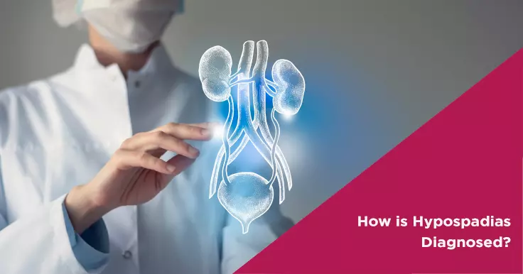  Hypospadias Diagnosis: How It Is Done?