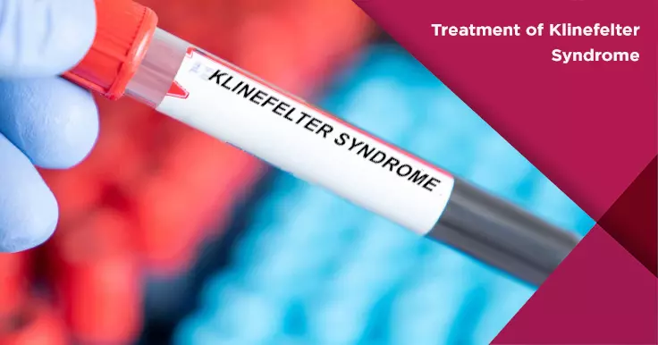  Treatment of Klinefelter Syndrome: Managing Symptoms and Improving Fertility