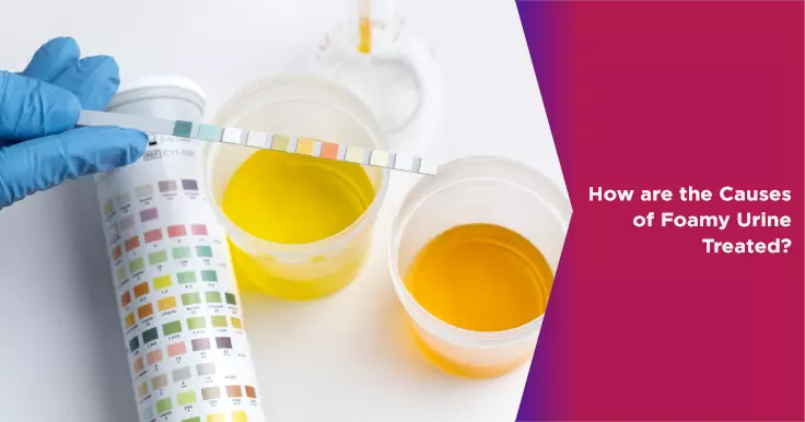  How Are the Causes of Foamy Urine Treated?