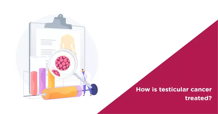   Testicular Cancer Treatment: Steps to Recovery and Fertility Preservation