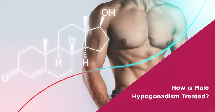  Male Hypogonadism Treatment: Effective Solutions for Hormonal Imbalance