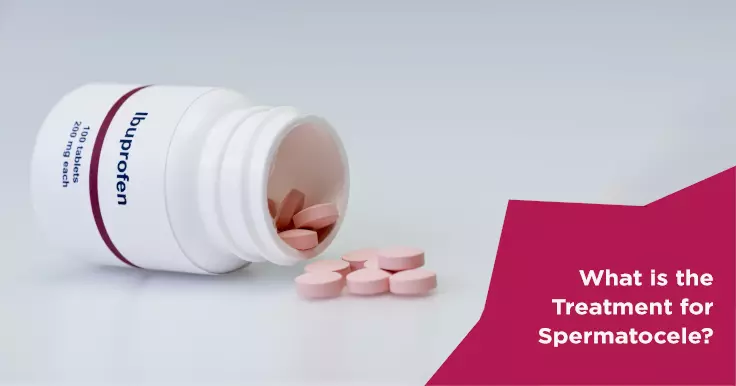  Spermatocele Treatment: Managing Fluid-Filled Cysts in the Testicles
