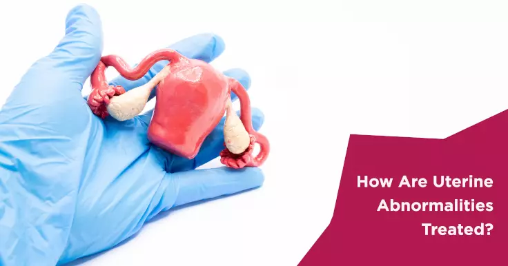  Uterine Abnormalities Treatment: Methods and Strategies