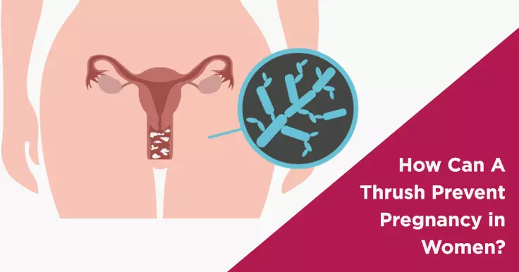  How Thrush Can Affect Pregnancy Chances in Women