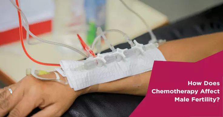  How Does Chemotherapy Affect Male Fertility?