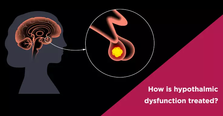  How Hypothalamic Dysfunction Is Treated?