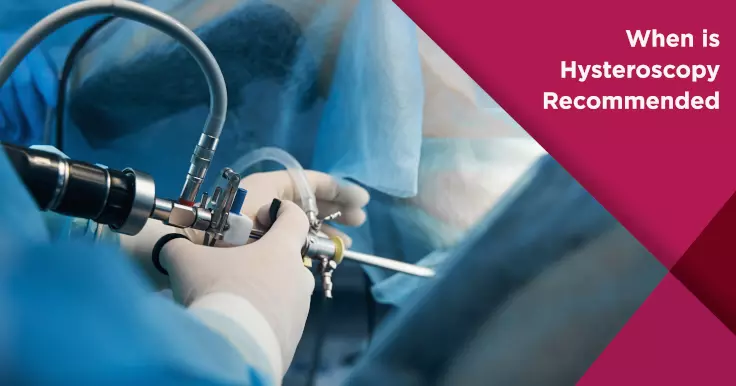  Hysteroscopy Procedure: What to Expect