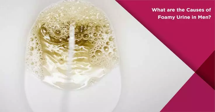  Foamy Urine in Men Causes and What It Means for Health