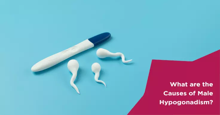  What are the Causes of Male Hypogonadism?