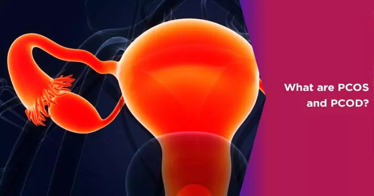  What Are PCOS and PCOD?
