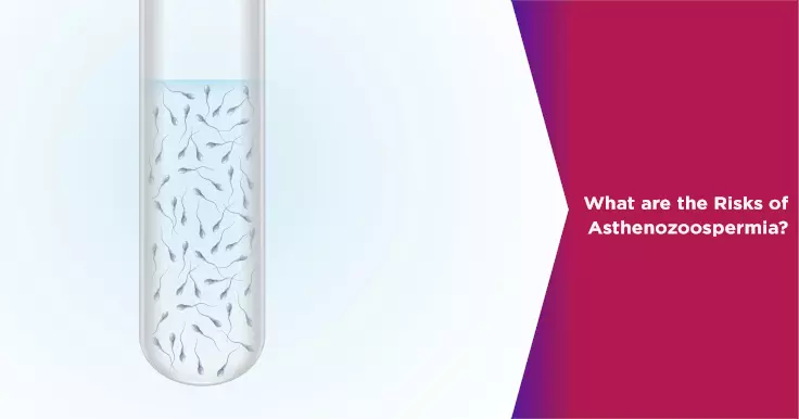  Asthenozoospermia Risks: Factors Affecting Sperm Motility