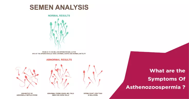  What are the Symptoms Of Asthenozoospermia?