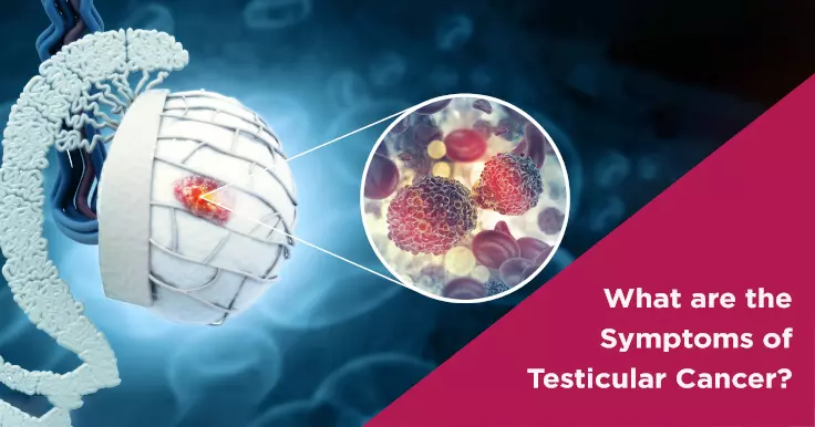  Testicular Cancer Symptoms: Early Detection and Fertility Impact