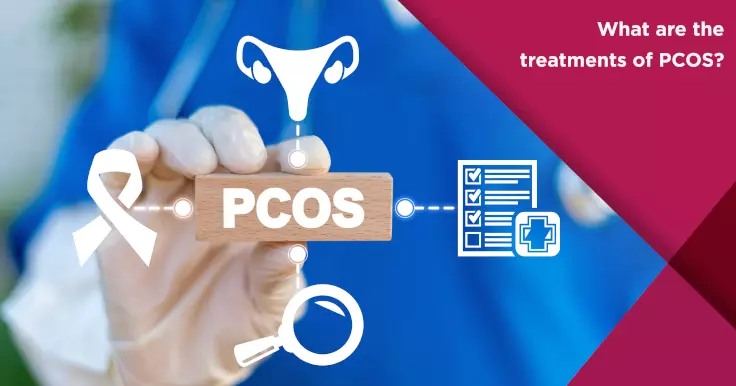  Treatments for PCOS: Understanding Your Options