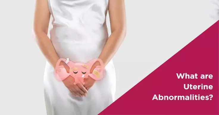  Understanding Uterine Abnormalities: Types and Implications