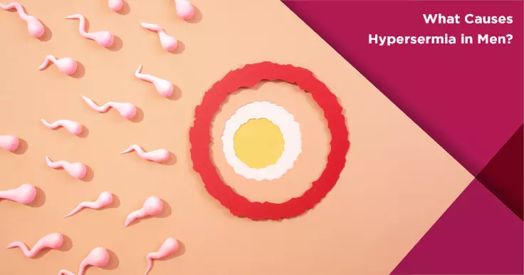 Causes of Hyperspermia in Men: Understanding This Rare Condition
