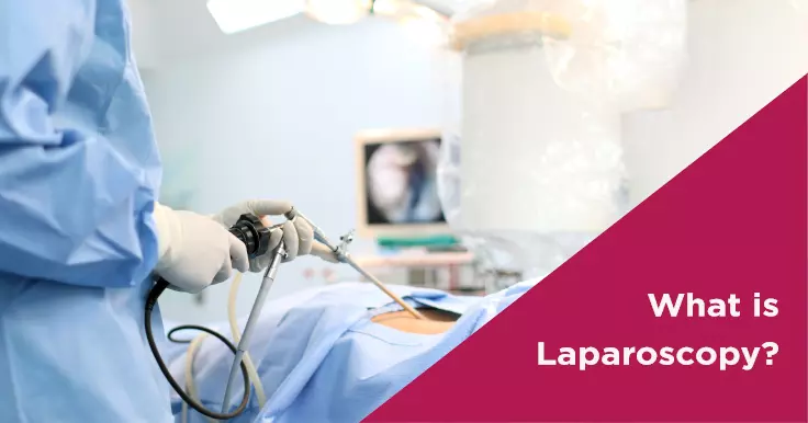 Laparoscopy: Meaning, Benefits, Procedure, and Risks 
