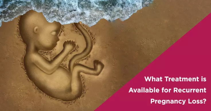  Available Treatments for Recurrent Pregnancy Loss