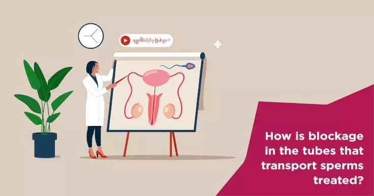  Treatment for Blocked Sperm Transport Tubes