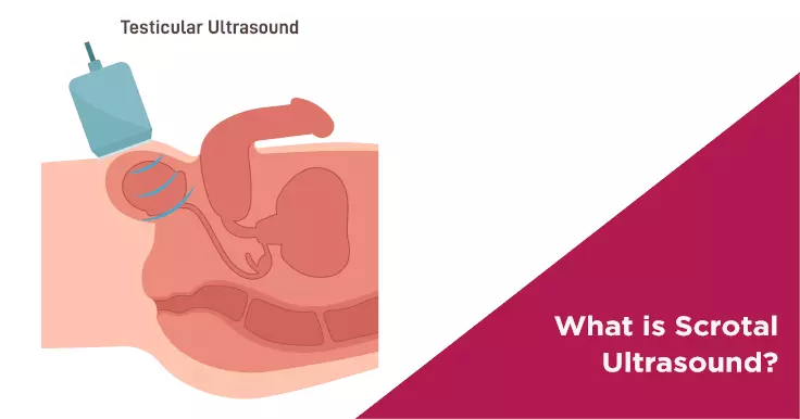 Everything You Need to Know About Scrotal Ultrasound