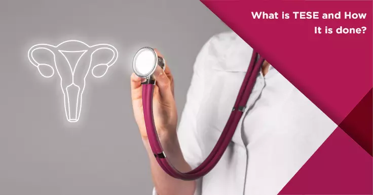 TESE Sperm Retrieval Procedures: A Guide for Infertility Treatment