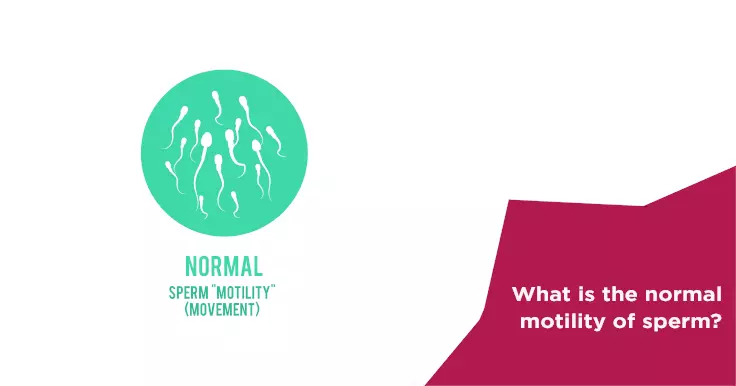 Understanding Sperm Motility: Key to Male Fertility