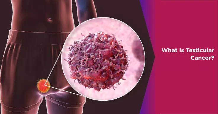 What is Testicular Cancer & its Types