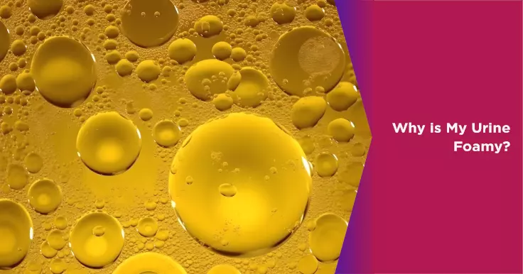  Why Is My Urine Foamy? Causes and Health Implications