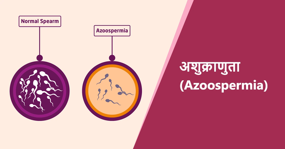 What is Azoospermia? Meaning and Implications in Hindi