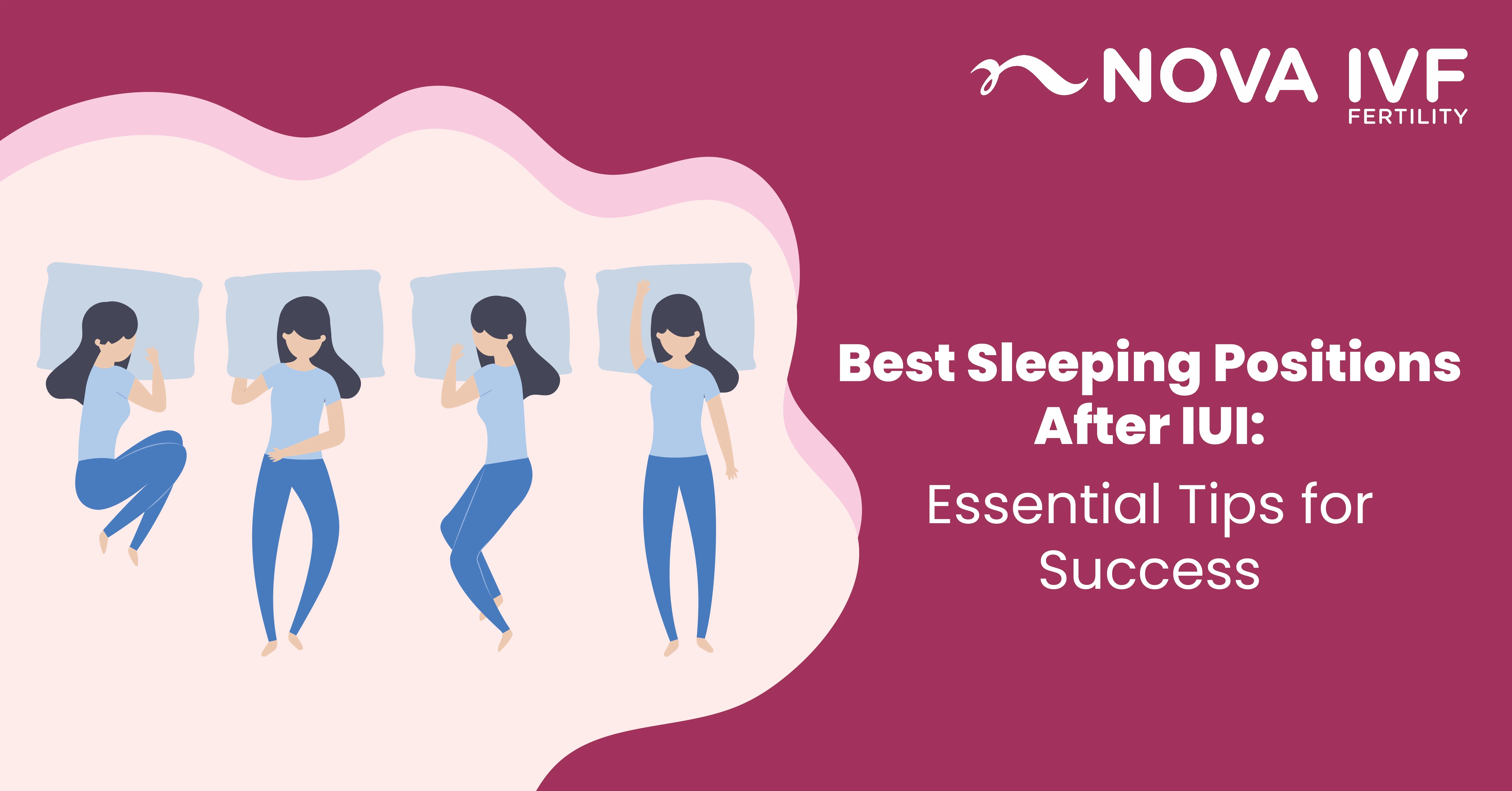 Optimal Sleeping Position After IUI: Tips for Better Success